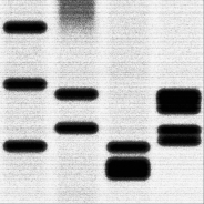 DNA sequencing gel